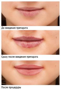images-stories-61_lips