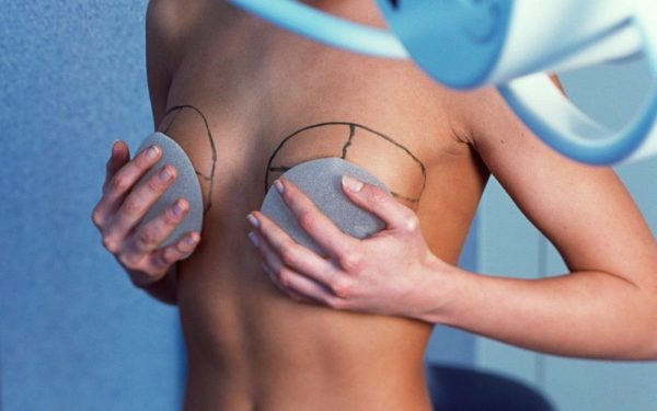 Имплантанты для увеличения груди